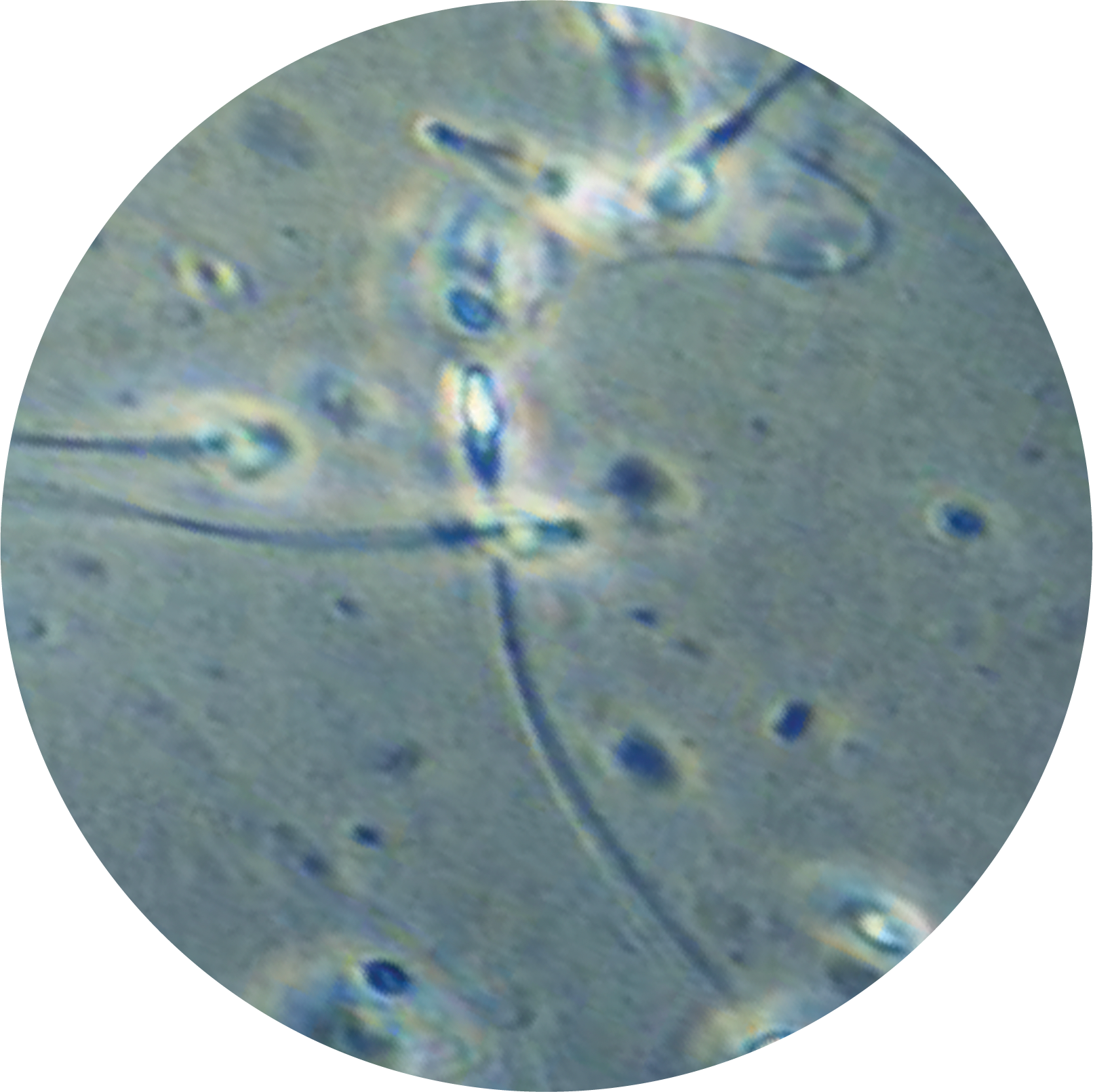 Sperm image